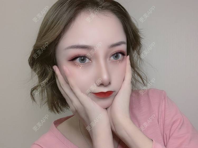 鼻翼缩小