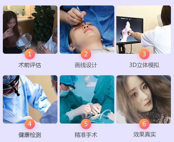 鼻整形医院